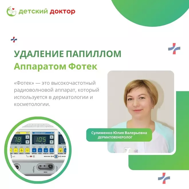Удаления папиллом аппаратом «Фотек»